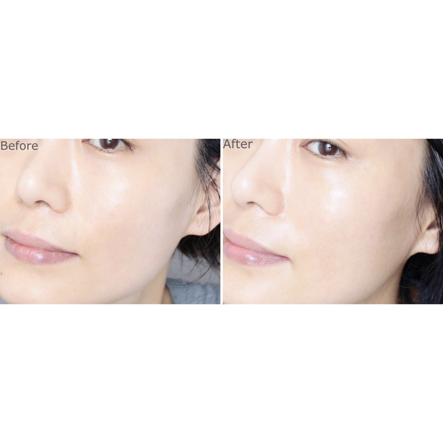 Azulene Relief Solution Ampoule